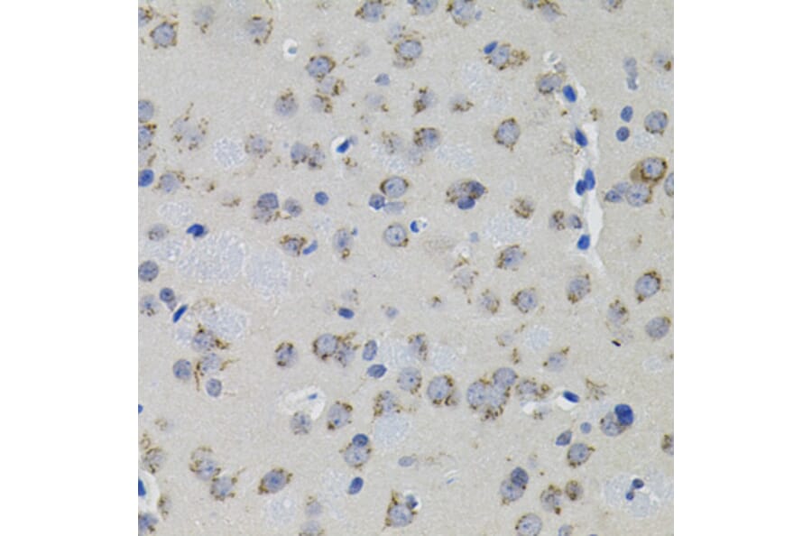 Immunohistochemistry - Anti-ACE Antibody (A7665) - Antibodies.com