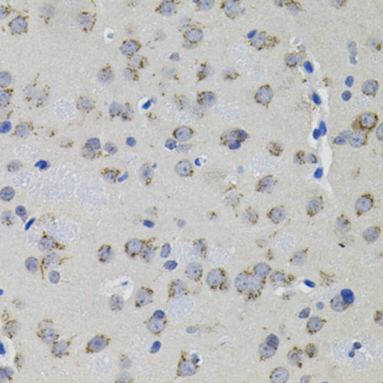 Immunohistochemistry - Anti-ACE Antibody (A7665) - Antibodies.com