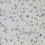 Immunohistochemistry - Anti-ACE Antibody (A7665) - Antibodies.com