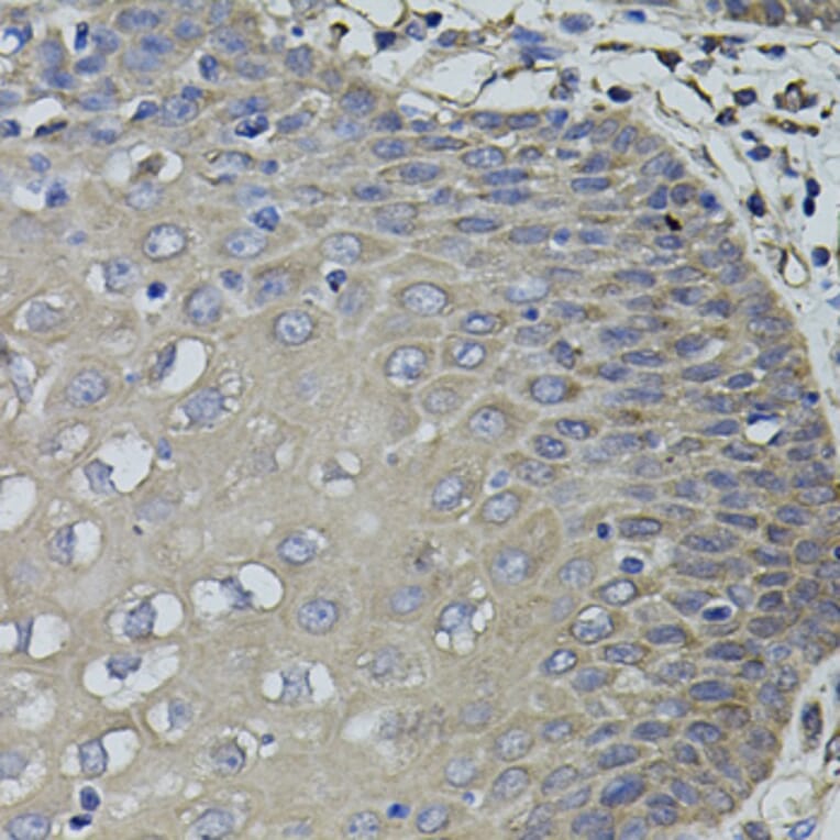 Immunohistochemistry - Anti-ACE Antibody (A7665) - Antibodies.com