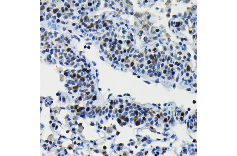 Immunohistochemistry - Anti-ARID3A Antibody (A15831) - Antibodies.com