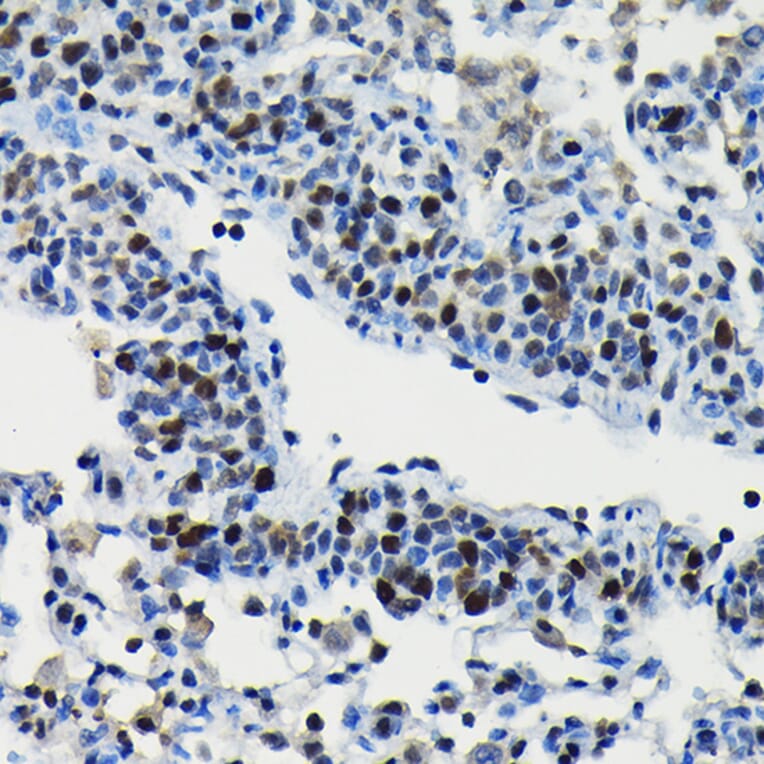 Immunohistochemistry - Anti-ARID3A Antibody (A15831) - Antibodies.com