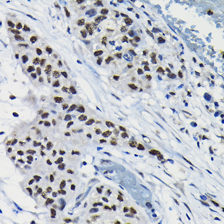 Immunohistochemistry - Anti-ARID3A Antibody (A15831) - Antibodies.com