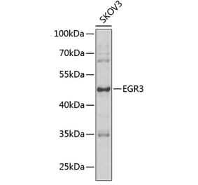 Western Blot - Anti-EGR3 Antibody (A15832) - Antibodies.com