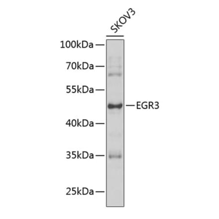 Western Blot - Anti-EGR3 Antibody (A15832) - Antibodies.com