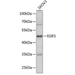 Western Blot - Anti-EGR3 Antibody (A15832) - Antibodies.com