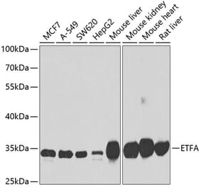 Western Blot - Anti-ETFA Antibody (A15833) - Antibodies.com