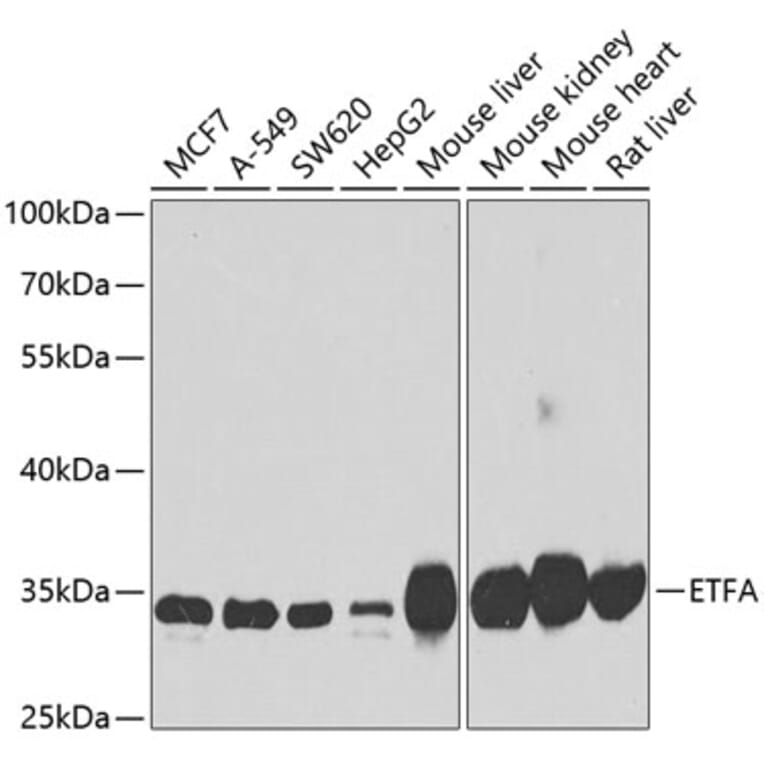 Western Blot - Anti-ETFA Antibody (A15833) - Antibodies.com