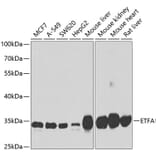 Western Blot - Anti-ETFA Antibody (A15833) - Antibodies.com