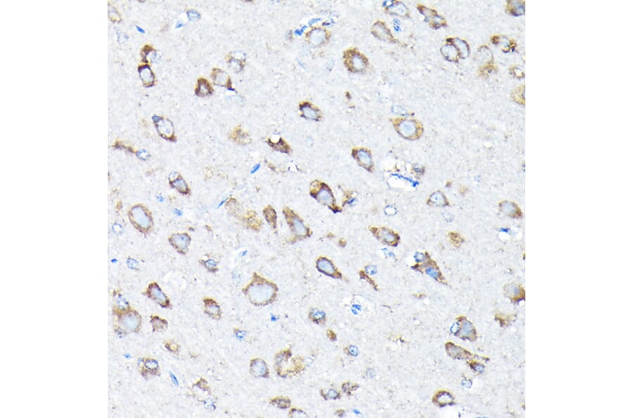 Immunohistochemistry - Anti-ETFA Antibody (A15833) - Antibodies.com