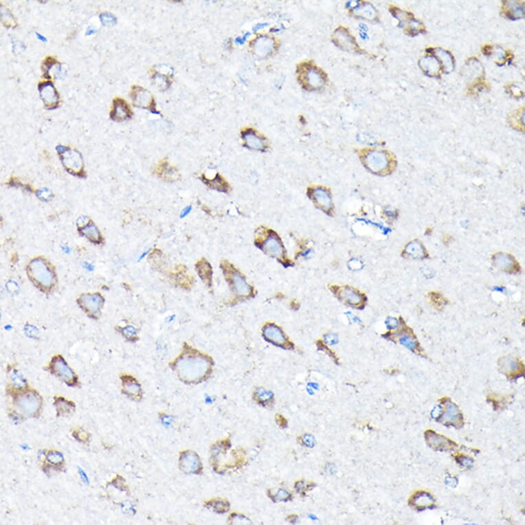 Immunohistochemistry - Anti-ETFA Antibody (A15833) - Antibodies.com