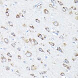 Immunohistochemistry - Anti-ETFA Antibody (A15833) - Antibodies.com