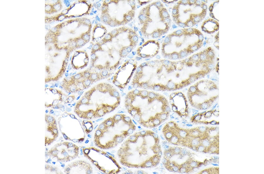 Immunohistochemistry - Anti-ETFA Antibody (A15833) - Antibodies.com