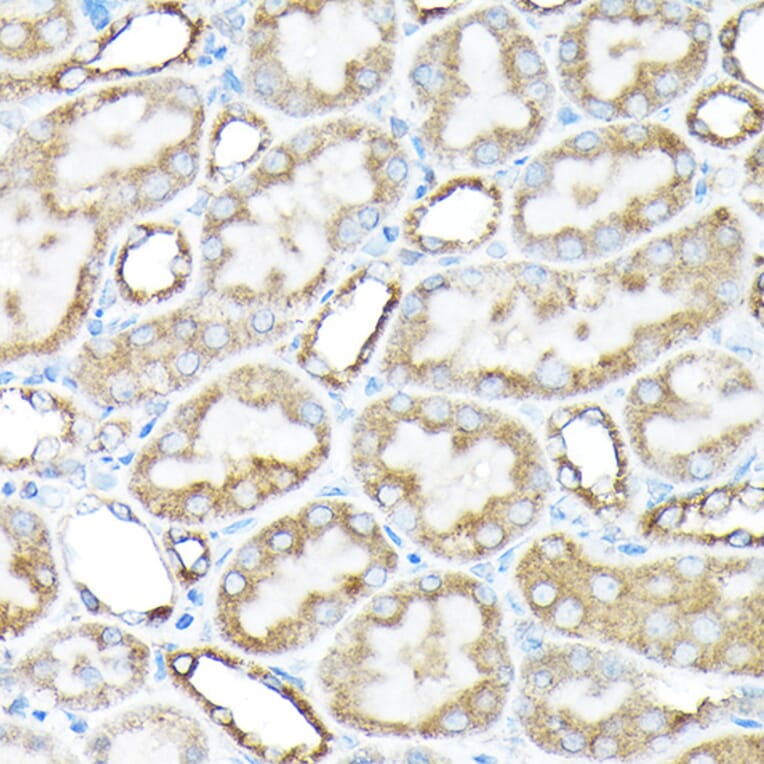 Immunohistochemistry - Anti-ETFA Antibody (A15833) - Antibodies.com