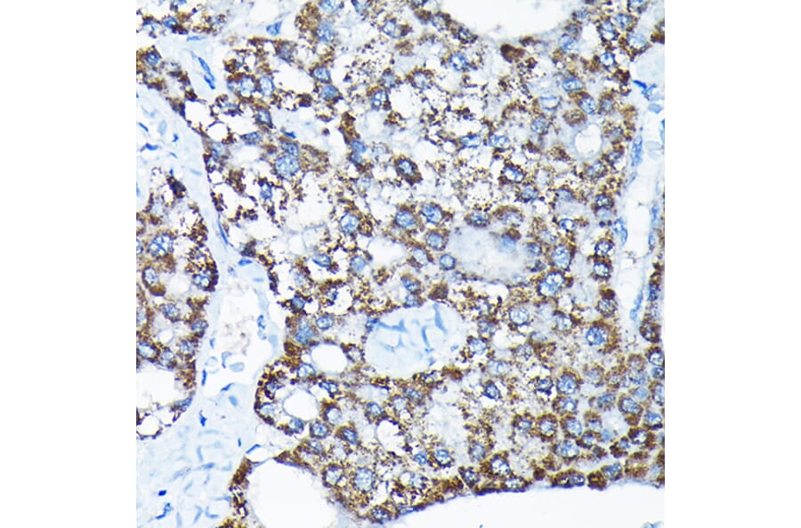 Immunohistochemistry - Anti-ETFA Antibody (A15833) - Antibodies.com