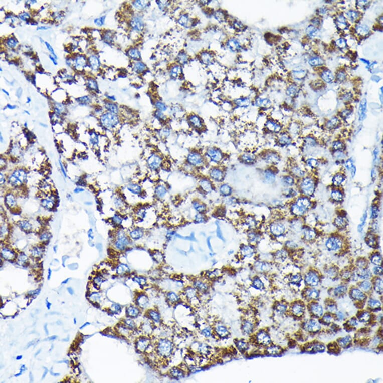 Immunohistochemistry - Anti-ETFA Antibody (A15833) - Antibodies.com