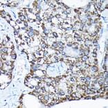 Immunohistochemistry - Anti-ETFA Antibody (A15833) - Antibodies.com