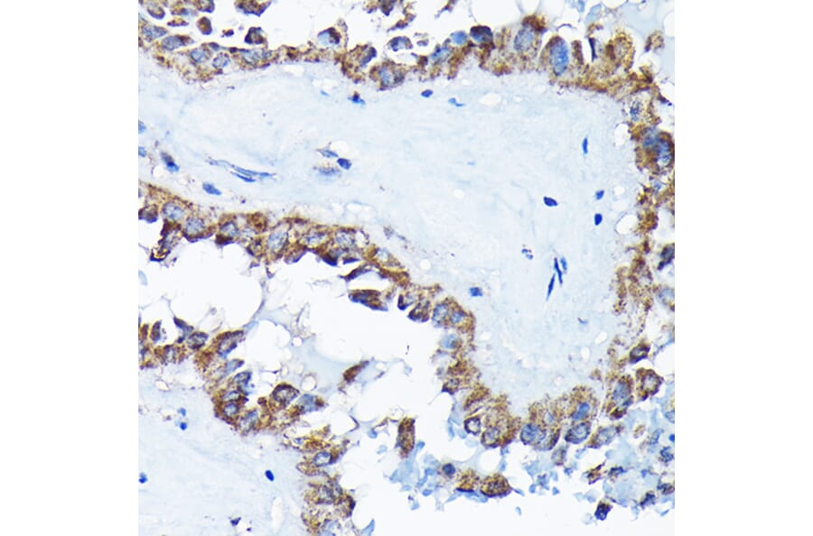 Immunohistochemistry - Anti-ETFA Antibody (A15833) - Antibodies.com