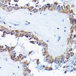 Immunohistochemistry - Anti-ETFA Antibody (A15833) - Antibodies.com