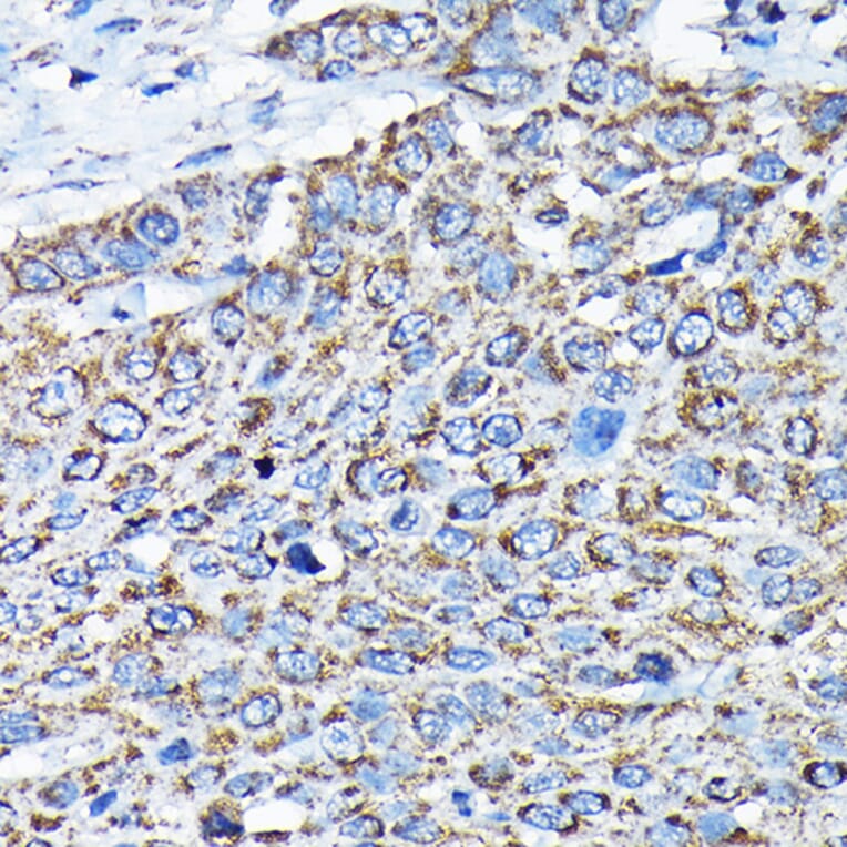 Immunohistochemistry - Anti-ETFA Antibody (A15833) - Antibodies.com