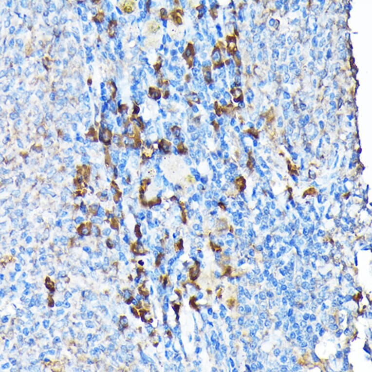 Immunohistochemistry - Anti-ETFA Antibody (A15833) - Antibodies.com