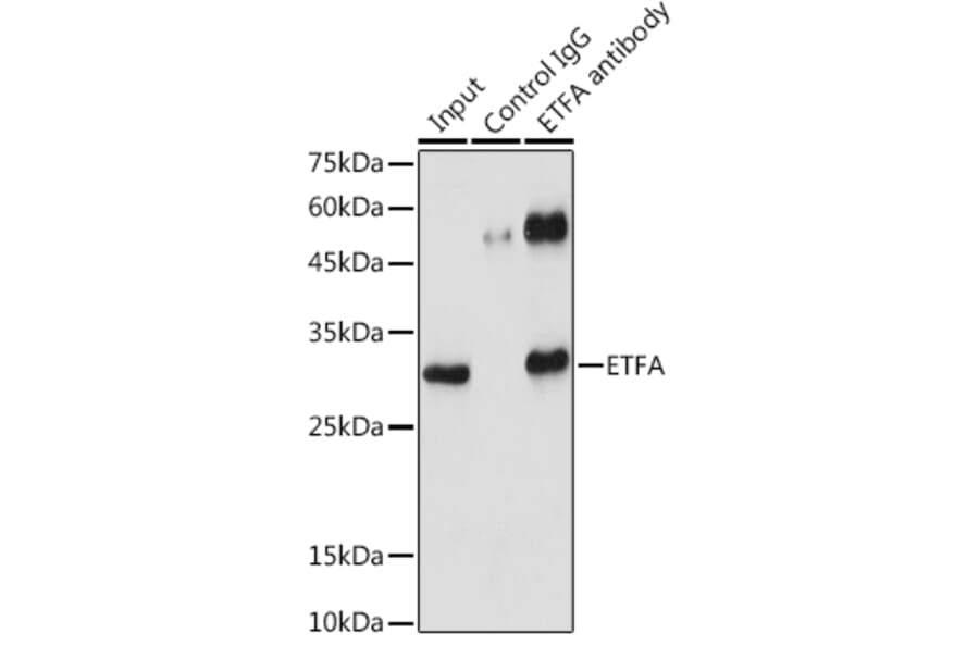 Western Blot - Anti-ETFA Antibody (A15833) - Antibodies.com