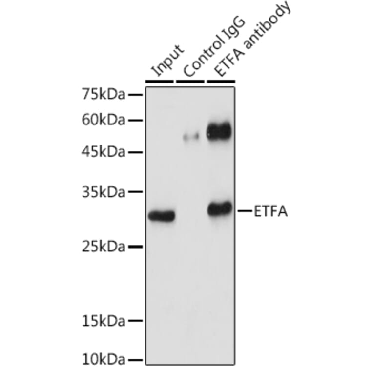 Western Blot - Anti-ETFA Antibody (A15833) - Antibodies.com