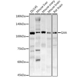 Western Blot - Anti-GAA Antibody (A15834) - Antibodies.com