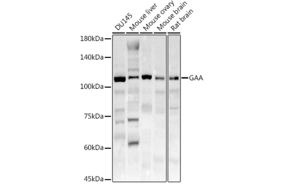 Western Blot - Anti-GAA Antibody (A15834) - Antibodies.com
