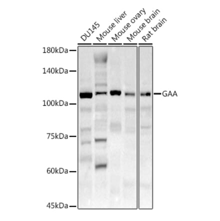 Western Blot - Anti-GAA Antibody (A15834) - Antibodies.com