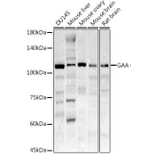 Western Blot - Anti-GAA Antibody (A15834) - Antibodies.com