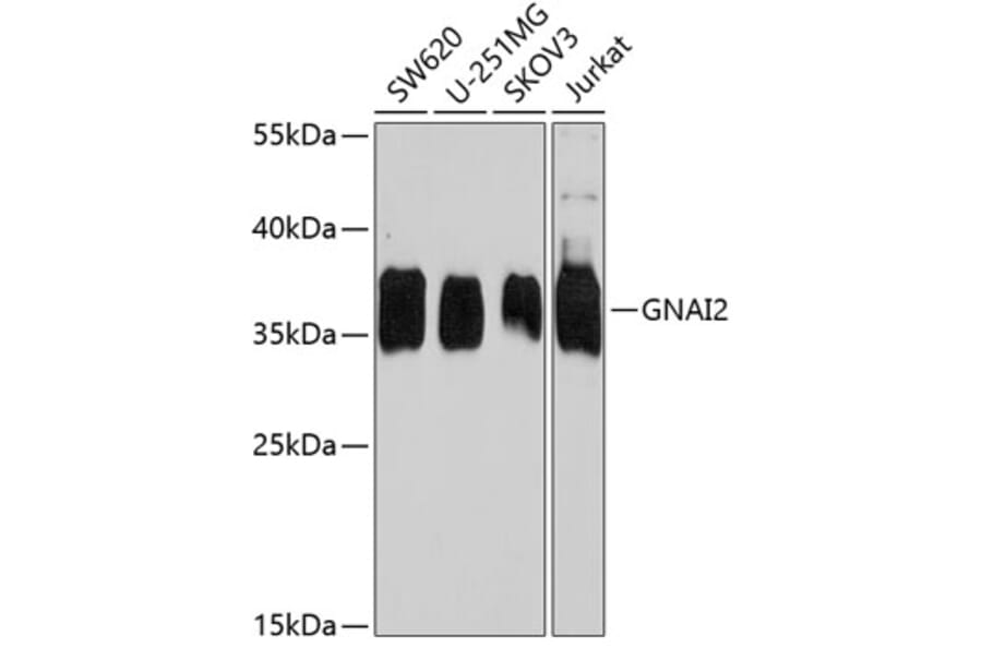 Western Blot - Anti-GNAI2 Antibody (A15835) - Antibodies.com