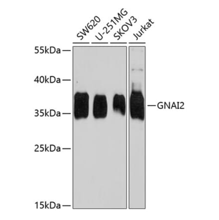 Western Blot - Anti-GNAI2 Antibody (A15835) - Antibodies.com
