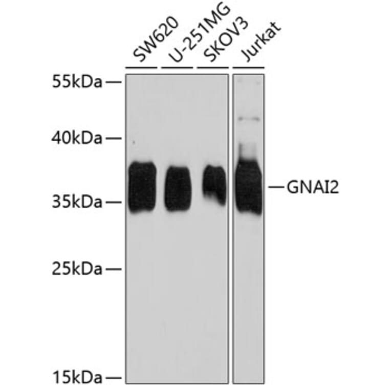 Western Blot - Anti-GNAI2 Antibody (A15835) - Antibodies.com