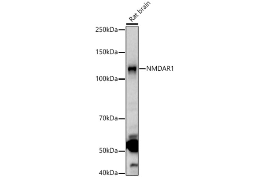 Western Blot - Anti-NMDAR1 Antibody (A15836) - Antibodies.com