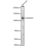 Western Blot - Anti-NMDAR1 Antibody (A15836) - Antibodies.com
