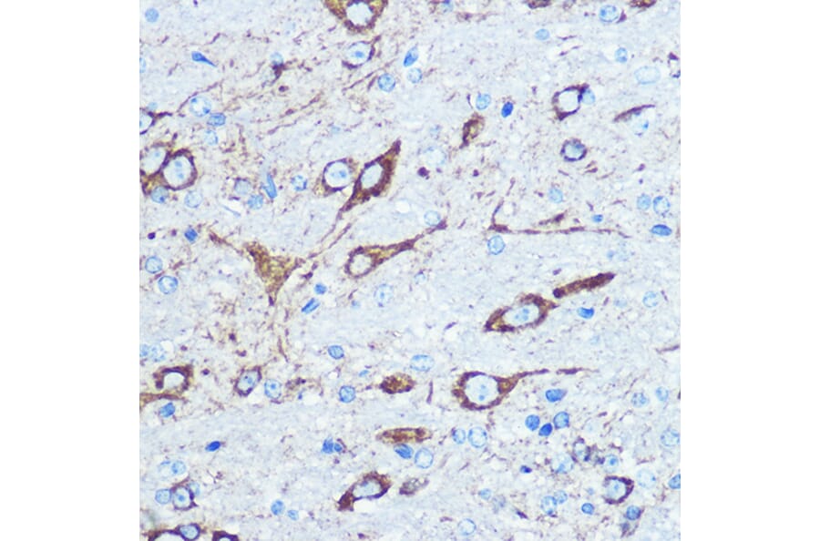 Immunohistochemistry - Anti-NMDAR1 Antibody (A15836) - Antibodies.com
