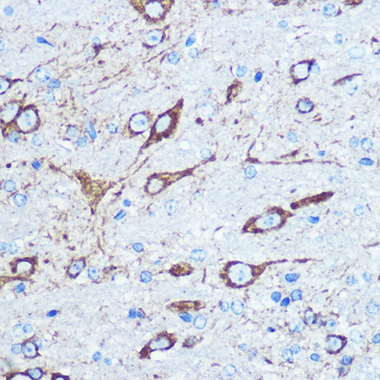 Immunohistochemistry - Anti-NMDAR1 Antibody (A15836) - Antibodies.com