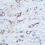 Immunohistochemistry - Anti-NMDAR1 Antibody (A15836) - Antibodies.com