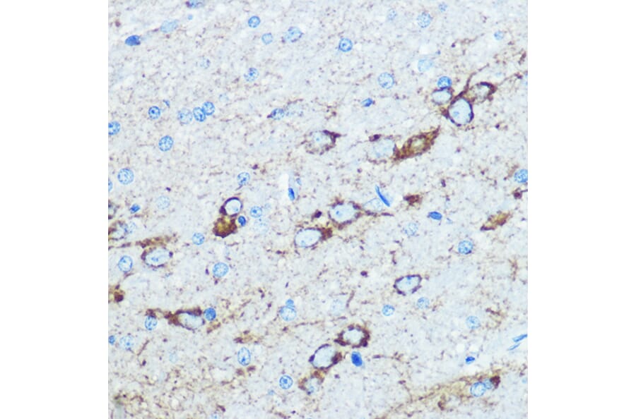 Immunohistochemistry - Anti-NMDAR1 Antibody (A15836) - Antibodies.com