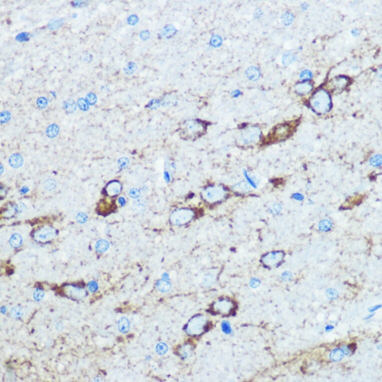 Immunohistochemistry - Anti-NMDAR1 Antibody (A15836) - Antibodies.com