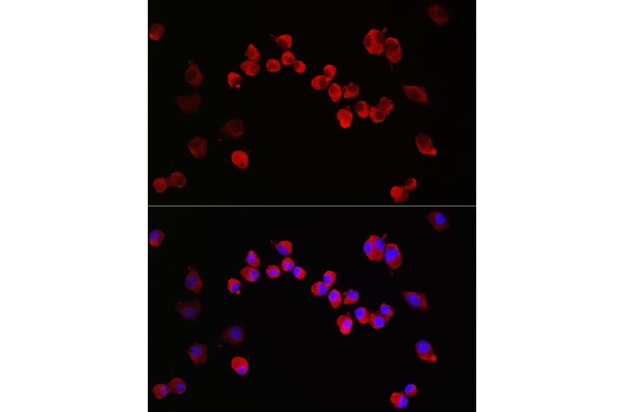 Immunofluorescence - Anti-NMDAR1 Antibody (A15836) - Antibodies.com