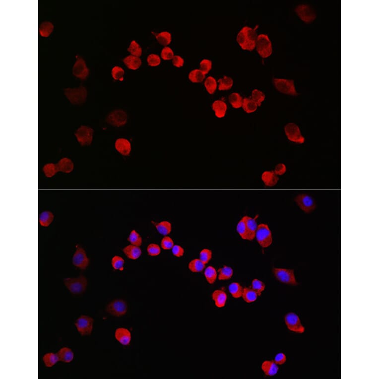 Immunofluorescence - Anti-NMDAR1 Antibody (A15836) - Antibodies.com