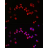 Immunofluorescence - Anti-NMDAR1 Antibody (A15836) - Antibodies.com