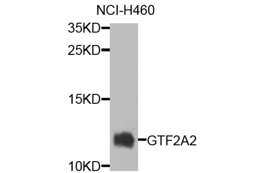 Western Blot - Anti-GTF2A2 Antibody (A7680) - Antibodies.com