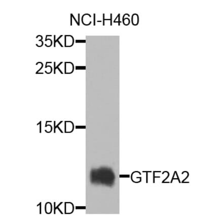 Western Blot - Anti-GTF2A2 Antibody (A7680) - Antibodies.com