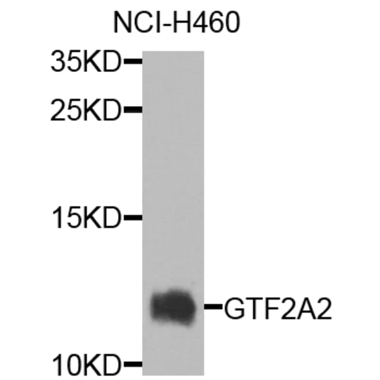 Western Blot - Anti-GTF2A2 Antibody (A7680) - Antibodies.com