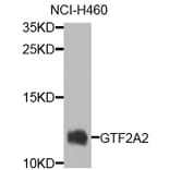 Western Blot - Anti-GTF2A2 Antibody (A7680) - Antibodies.com