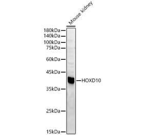 Western Blot - Anti-HOXD10 Antibody (A15839) - Antibodies.com