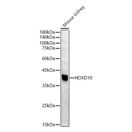 Western Blot - Anti-HOXD10 Antibody (A15839) - Antibodies.com